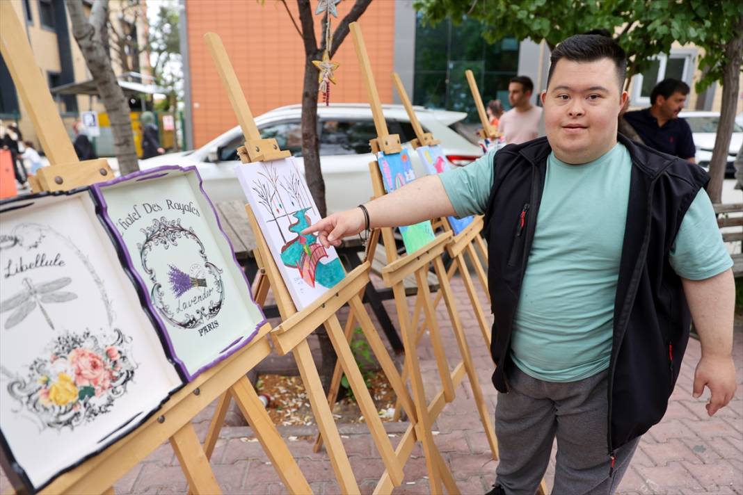 Haftalar içinde ölecekti! Konya'da sanatıyla hastalığı yendi 3